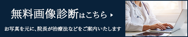 画像による無料診断はこちら