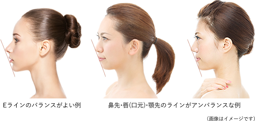 Eライン形成・整形術（鼻先・口元・あご先の整形）とは