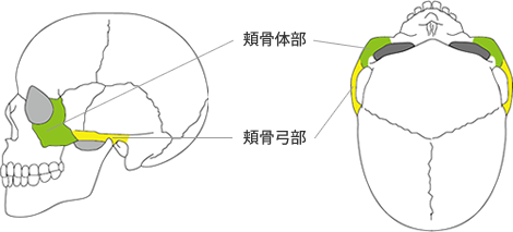 〇頬骨整形の手術適応（本施術が適している方）