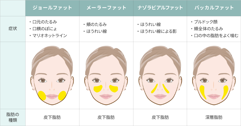 ジョールファット除去とは