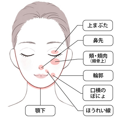 カベリン注射（脂肪溶解注射）の施術部位