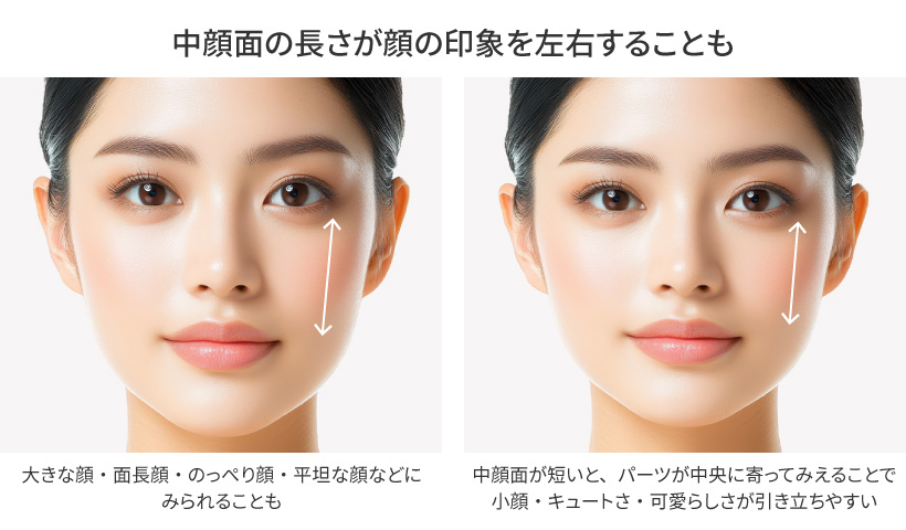 中顔面の長さが顔の印象を左右することも