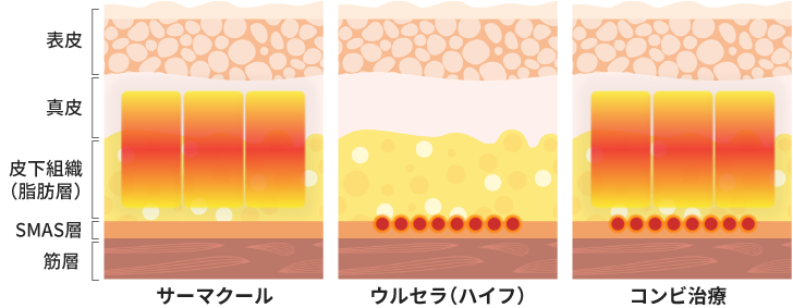 【アプローチ層イメージ】