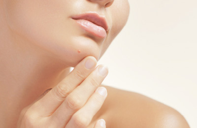 肉感のある広範囲に及ぶたるみ治療に適した治療