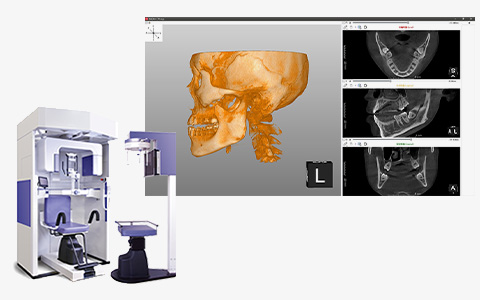 院内CT検査を導入迅速・緻密な手術を実現