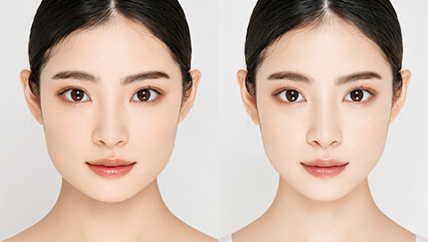術前に精密な術後3Ｄ画像で仕上がりを確認できます